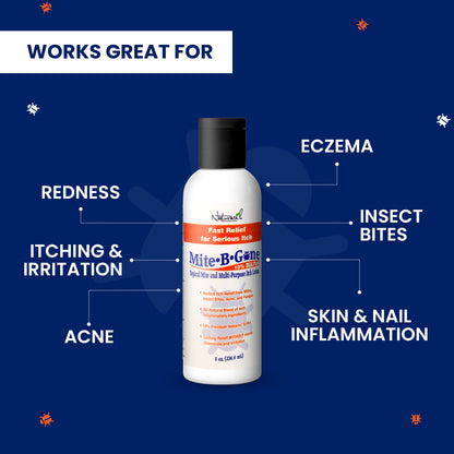 Mite-B-Gone 10% Sulfur Lotion (8oz) | Itch Relief from Mites, Insect Bites, Acne, and Fungus