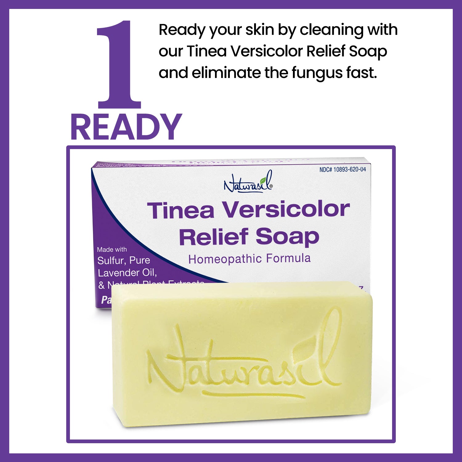 What Is Tinea Versicolor & What Does it Look Like? – Naturasil