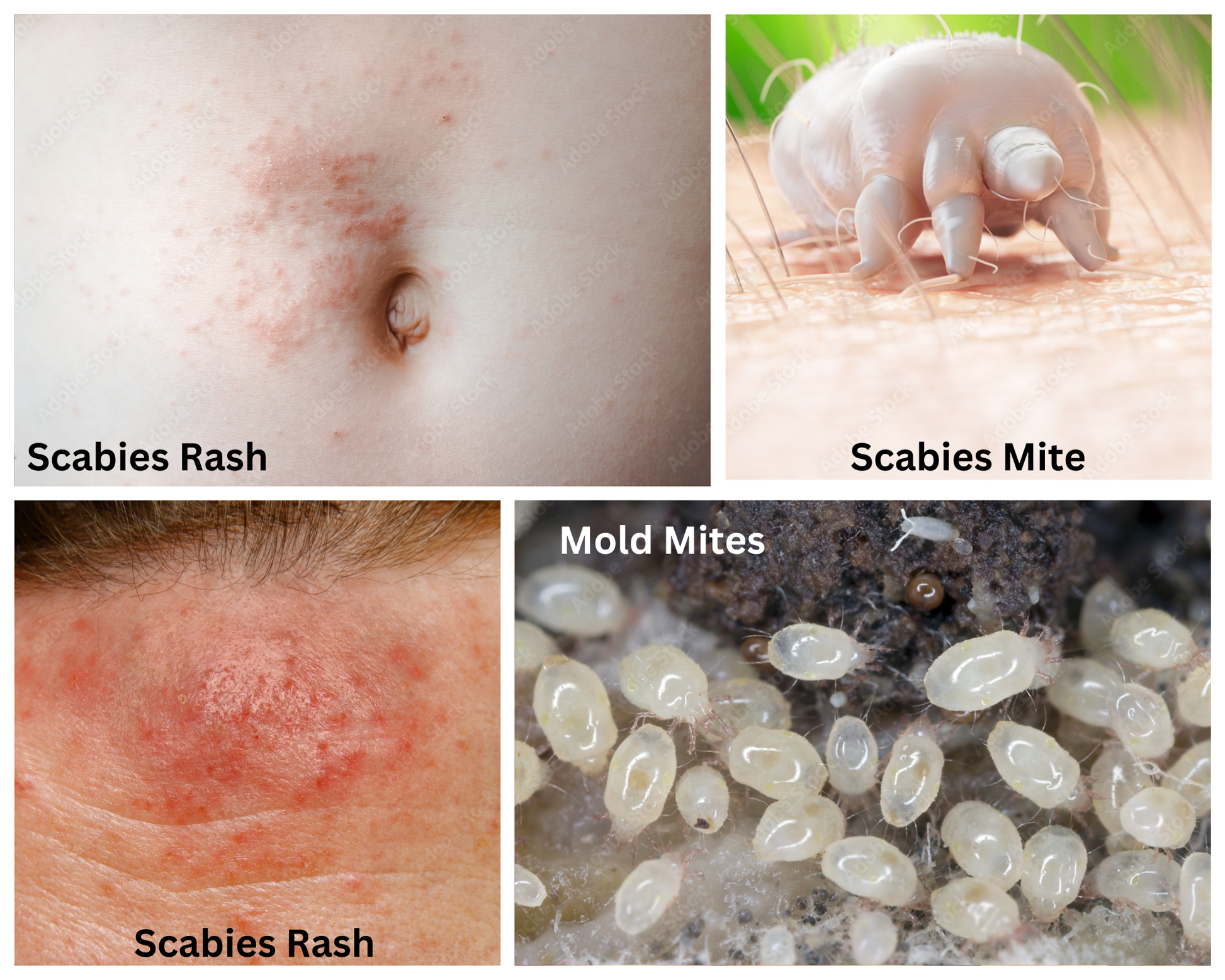 🔴 Dermaclin or Grisi Sulfur Soap 🔴 for Scabies (Caracha or Jiote) and  FUNGI in Dogs 